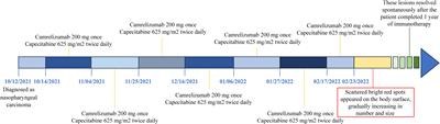 A case report and literature review on reactive cutaneous capillary endothelial proliferation induced by camrelizumab in a nasopharyngeal carcinoma patient